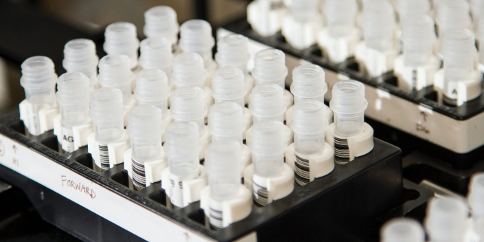 Nucleic Acid Extraction 